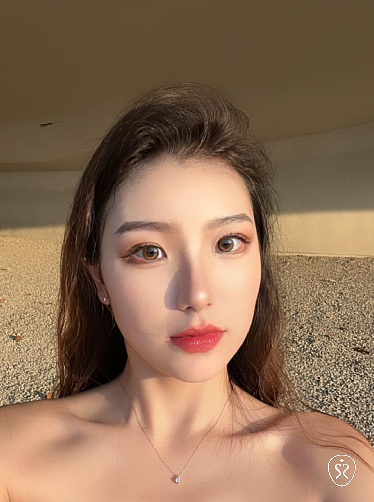 喬雅登玻尿酸 VOLUMA 與 VOLIFT 改善法令紋效果驚豔